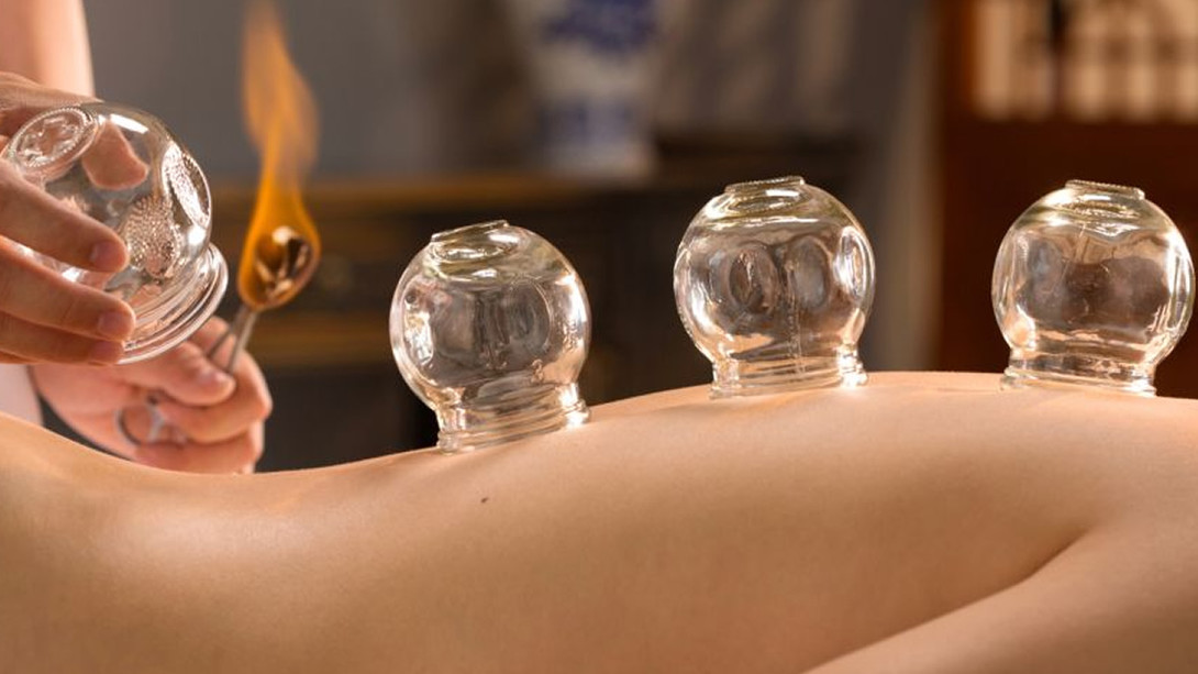 Cupping therapy for pain